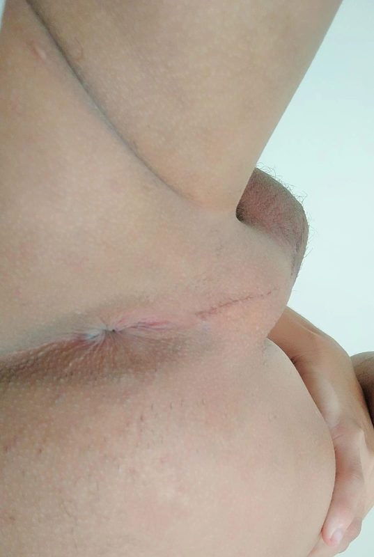 Novinho 20cm 14