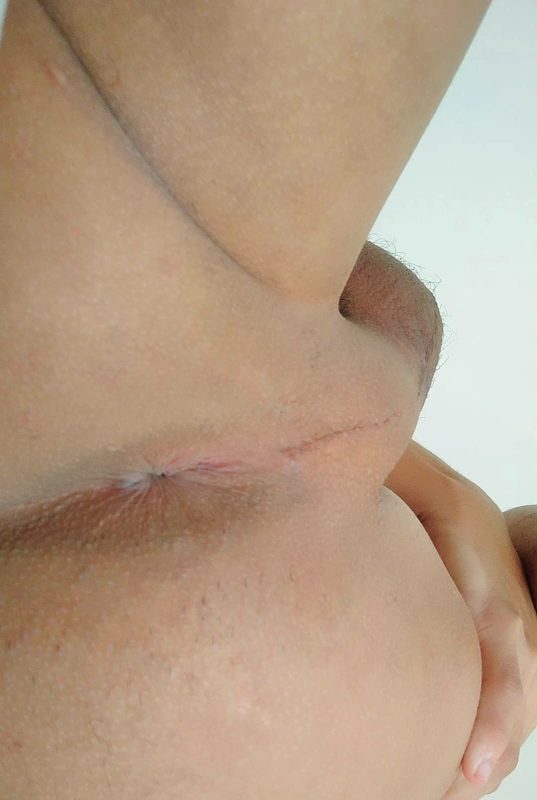 Novinho 20cm 6