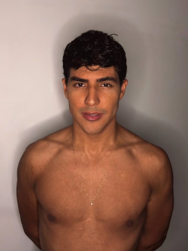 Fernando 3