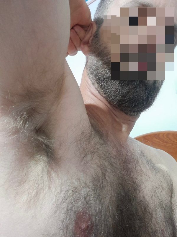Peludo Dotado 10