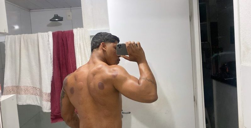 Garoto Malhado
