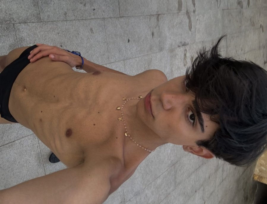 Erick