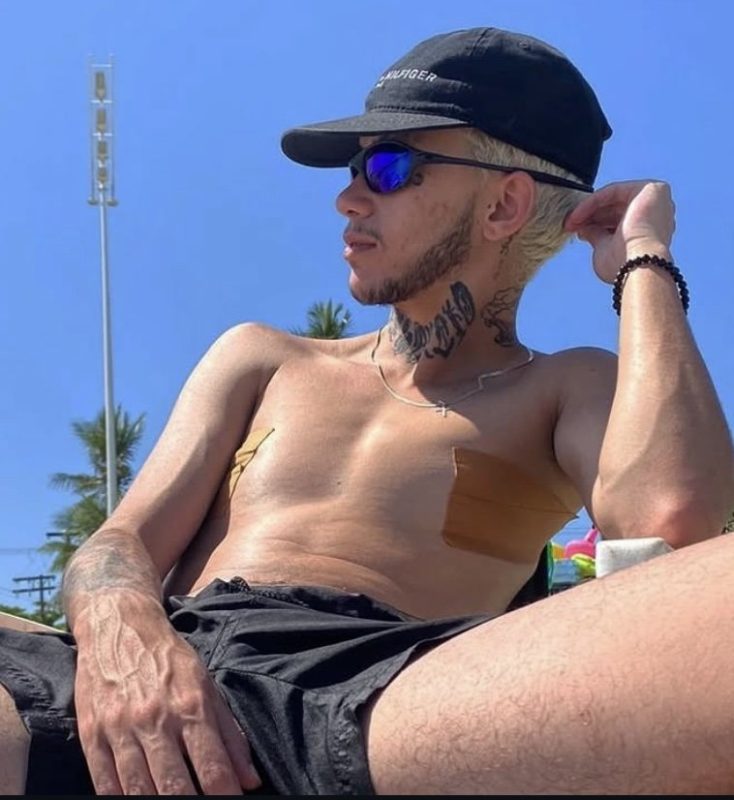 Henrique Ftm - Homem Trans 10