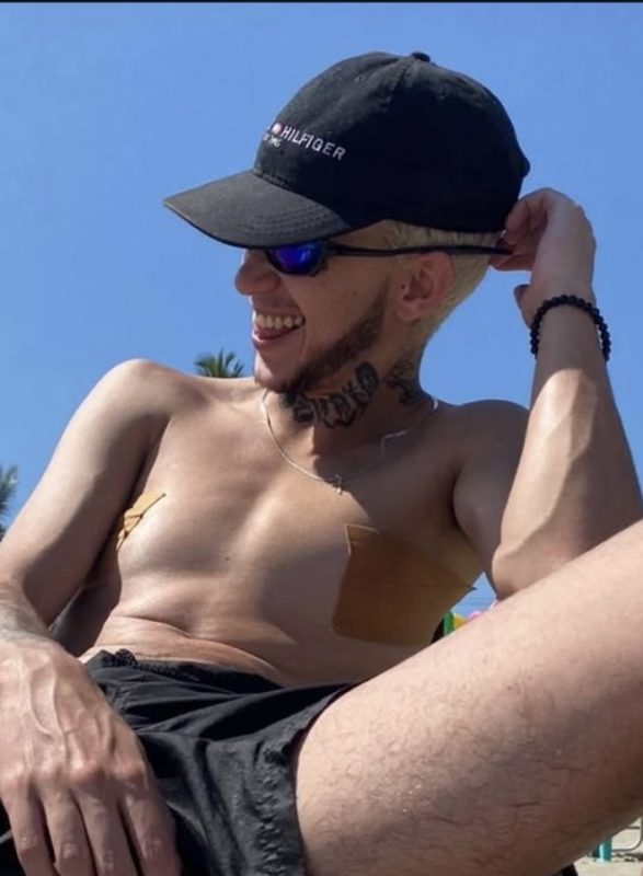 Henrique Ftm - Homem Trans 9